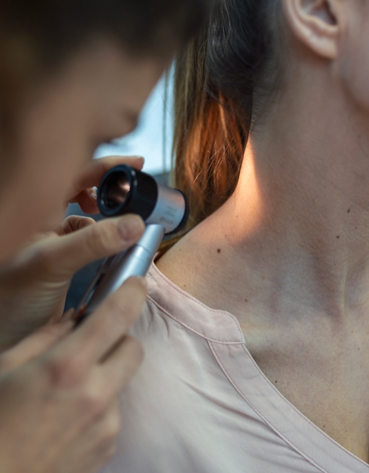 Dermatoskopi ile Ben Muayenesi Adana, Ben Aldırma Adana, Radyofrekans Ben Alma Adana, Ben Tedavisi Fiyatları, Lazerle Ben Aldırma Adana