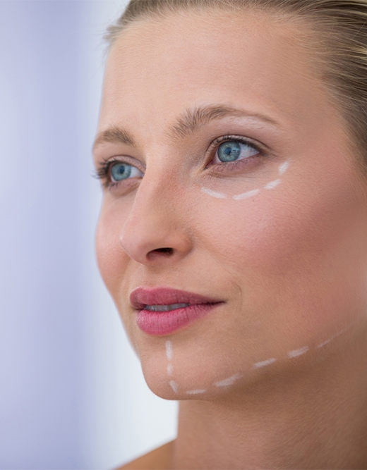 İPLE YÜZ GERME İPLİKLE ASKILAMA