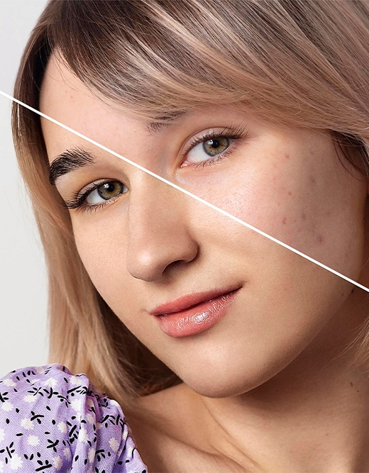 Adana Kimyasal Peeling, Adana Kimyasal Peeling Merkezleri, Kimyasal Peeling Adana Ücretleri, Adana Kimyasal peeling fiyatları 2024, Kimyasal Peeling Adana, Adana kimyasal peeling uygulaması, Adana kimyasal peeling yorumlar, Adana kimyasal peeling sonrası, Adana kimyasal peeling kullananlar, Adana kimyasal peeling faydaları, Adana kimyasal peeling fiyati 2024, Adana kimyasal peeling süslü