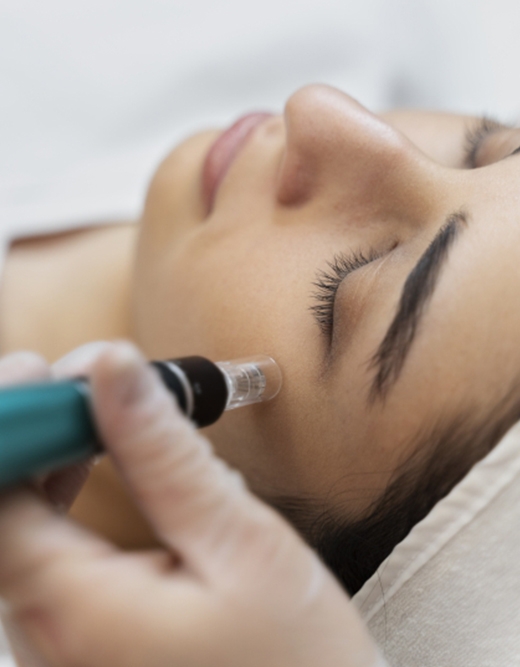 LAZERLE GÖZ ALTI MORLUĞU TEDAVİSİ