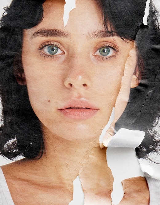 PLEXR İLE AMELİYATSIZ GÖZ KAPAĞI ESTETİĞİ